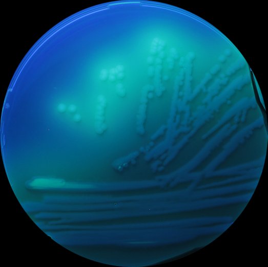 Pseudomonas aeruginosa Kultur